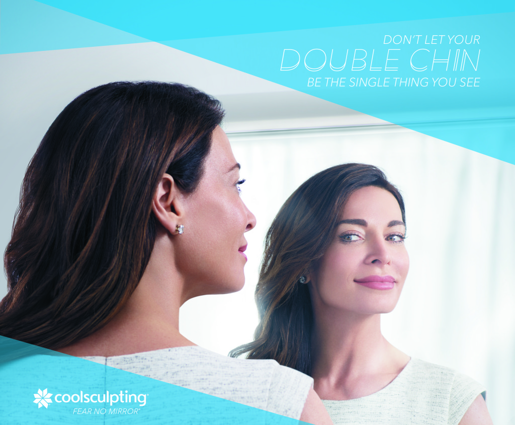 coolsculpting-submental-female-double-chin